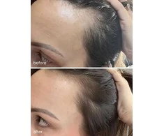 UKLASH - Ukhair plaukų augimo serumas 30ml