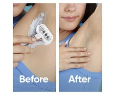 Skustuvo moterims Gillette Venus Deluxe Smooth Sensitive keičiamos galvutės, 10 vnt.