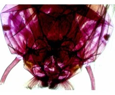 Deltaoptinis mikroskopas Biolight 300