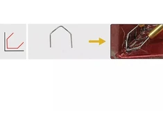 Kabių Rinkinys Plastiko Suvirintojams