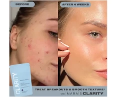 Imarais Beauty IMARIAS BEAUTY - CLARITY - GUMINUKAI NUO SPŪKIŲ Žaliasis obuolys - 30 vnt.