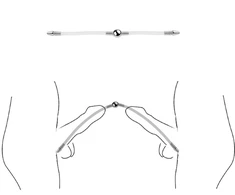 Dvigubas šlaplės dilatatorius, 24 cm