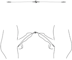 Dvigubas šlaplės dilatatorius, 34 cm