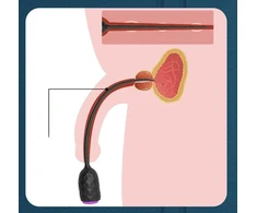 Vibruojanti šlaplės lazdelė Vibrating Penis Plug, 3 mm