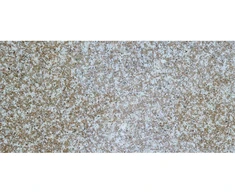 Granito plytelės G664
