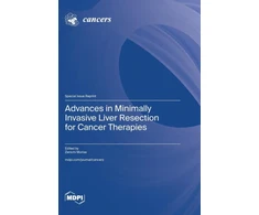 KNYGA Bookshop Advances in Minimally Invasive Liver Resection for Cancer Therapies