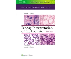 KNYGA Jonathan I Epstein Biopsy Interpretation of the Prostate