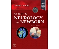 KNYGA Joseph J Volpe Volpe's Neurology of the Newborn
