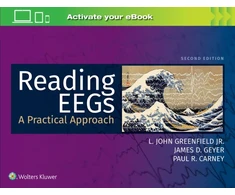 KNYGA John Reading EEGs: A Practical Approach