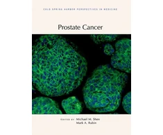 KNYGA Michael Shen Prostate Cancer