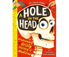 KNYGA Suzie Edge Hole in the Head, A gruesomely grisly history of medical firsts