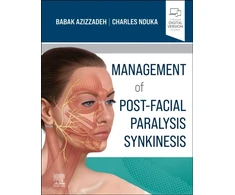 KNYGA Babak Azizzadeh MD FACS Management of Post-Facial Paralysis Synkinesis