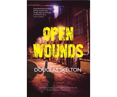 KNYGA Douglas Skelton Open Wounds