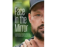 KNYGA Jack El Hai Face Transplant