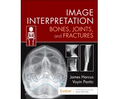 KNYGA James Harcus Image Interpretation: Bones, Joints, and Fractures