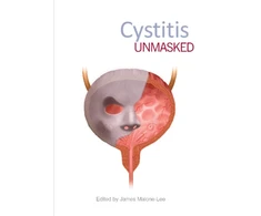 KNYGA James Malone Lee Cystitis Unmasked