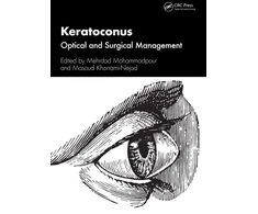 KNYGA Mehrdad Mohammadpour Keratoconus