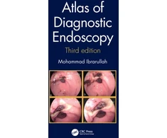 KNYGA Mohammad Ibrarullah Atlas of Diagnostic Endoscopy, 3E