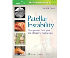 KNYGA Shital N Parikh Patellar Instability