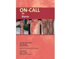 KNYGA Weale Mantelakis On-Call in Burns