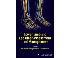 KNYGA Aby Mitchell Lower Limb and Leg Ulcer Assessment and Management