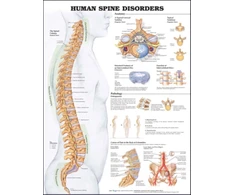 KNYGA Human Spine Disorders Anatomical Chart
