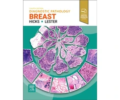 KNYGA Susan C., MD, PhD (Former Chief of Breast Pathology Services, Brigham and Women's Hospital, Associate Professor, Harvard Medical School, Boston, Massachusetts, USA) Lester Diagnostic Pathology: Breast
