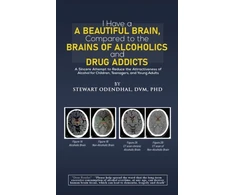 KNYGA DVM, PhD, Stewart Odendhal I Have a Beautiful Brain, Compared to the Brains of Alcoholics and Drug Addicts