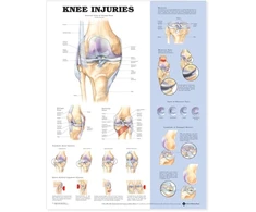 KNYGA Bookshop Knee Injuries Anatomical Chart