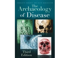 KNYGA Charlotte A Roberts Archaeology of Disease