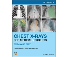 KNYGA Christopher Clarke Chest X-Rays for Medical Students