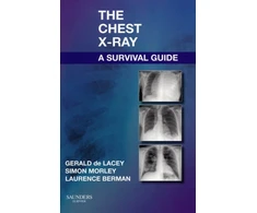 KNYGA Gerald De Lacey Chest X-Ray: A Survival Guide