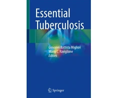 KNYGA Giovanni Battista Migliori Essential Tuberculosis