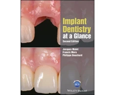 KNYGA Jacques Malet Implant Dentistry at a Glance