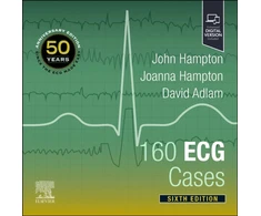 KNYGA John Hampton 160 ECG Cases