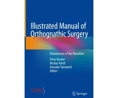 KNYGA Peter Kessler Illustrated Manual of Orthognathic Surgery