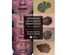 KNYGA Richard Ashton Differential Diagnosis in Dermatology