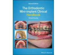 KNYGA Richard Cousley Orthodontic Mini-implant Clinical Handbook
