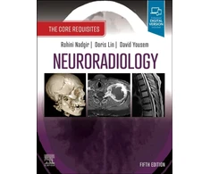 KNYGA Rohini Nadgir Neuroradiology