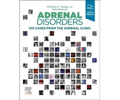 KNYGA Young, William F., Jr. Adrenal Disorders