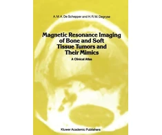 KNYGA Ama De Schepper Magnetic Resonance Imaging of Bone and Soft Tissue Tumors and Their Mimics