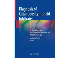 KNYGA Antonio Subtil Diagnosis of Cutaneous Lymphoid Infiltrates