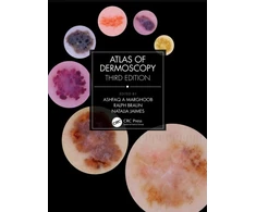 KNYGA Ashfaq A Marghoob Atlas of Dermoscopy
