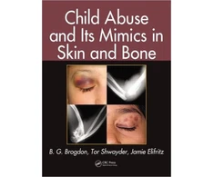 KNYGA B G Brogdon Child Abuse and its Mimics in Skin and Bone