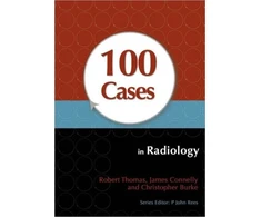 KNYGA Bookshop 100 Cases in Radiology