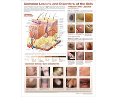 KNYGA Bookshop Common Lesions and Disorders of the Skin Anatomical Chart