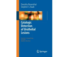 KNYGA Bookshop Cytologic Detection of Urothelial Lesions
