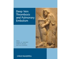 KNYGA Bookshop Deep Vein Thrombosis and Pulmonary Embolism