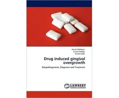 KNYGA Bookshop Drug induced gingival overgrowth