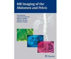 KNYGA Bookshop MR Imaging of the Abdomen and Pelvis